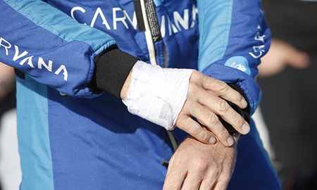 thumbnail for Johnson Plans To Drive in IMS Open Test after Hand Surgery